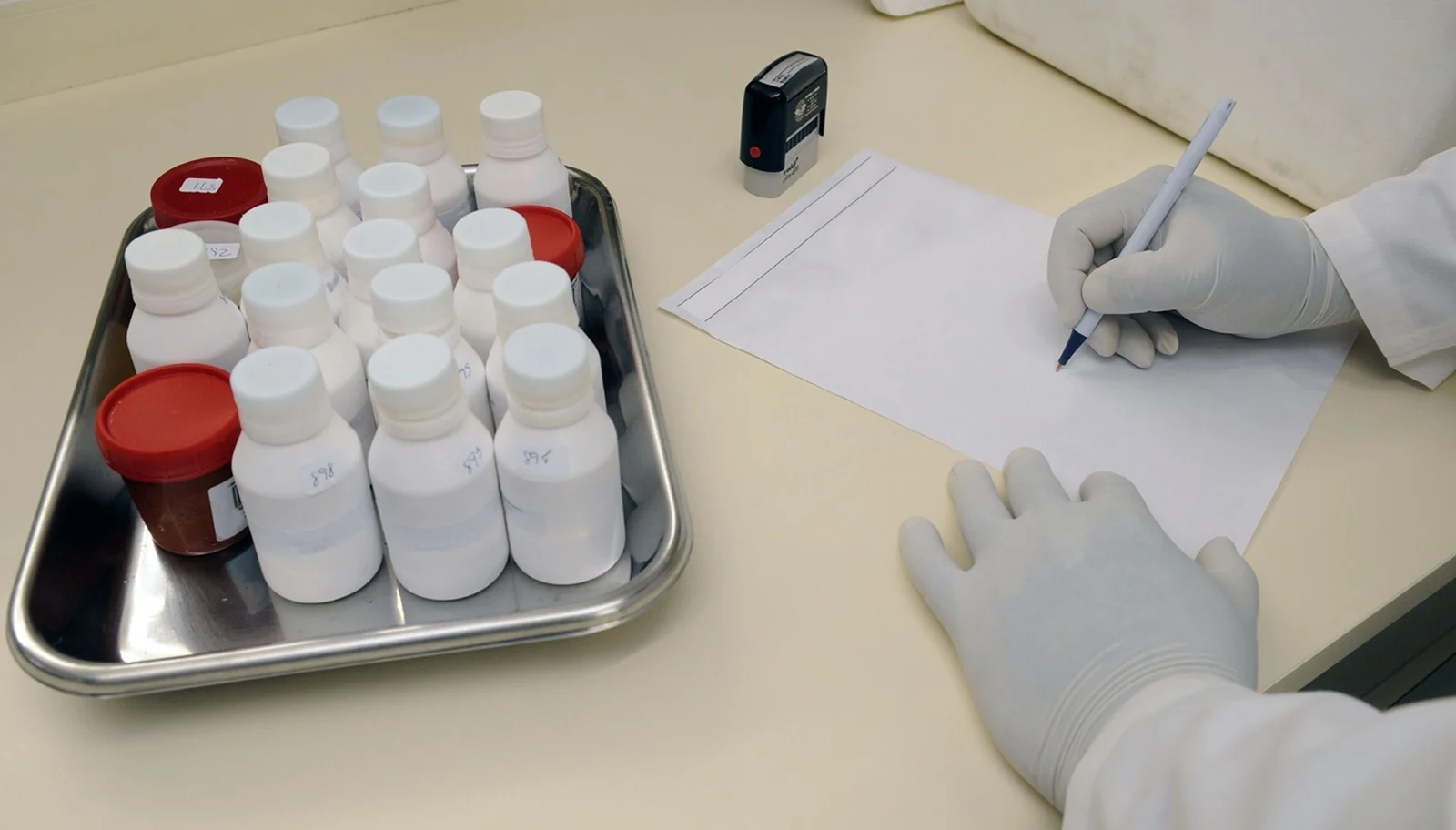 Lab technician in gloves writing a test report next to samples