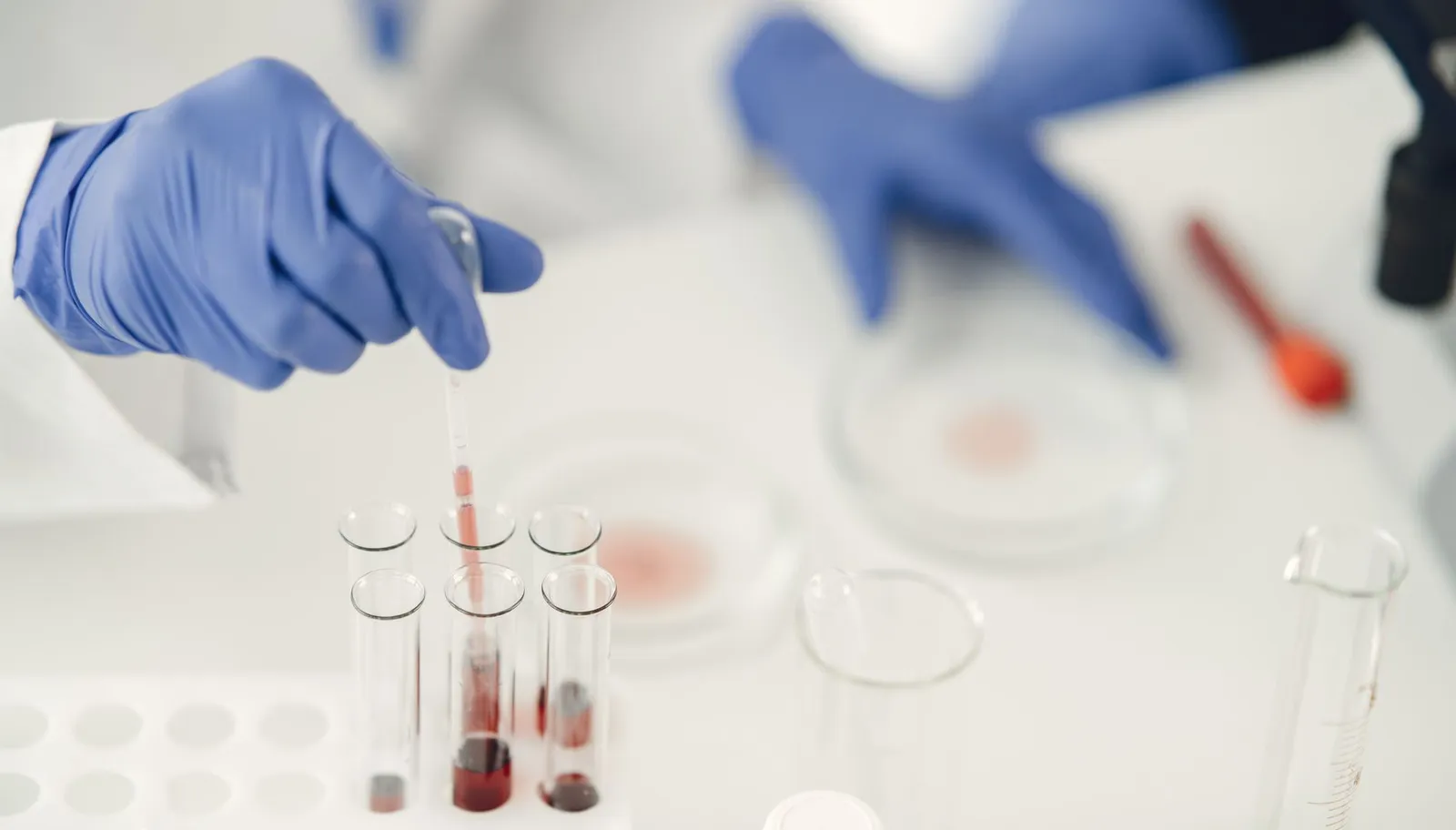 Lab technician in gloves using a pipette to prepare samples for testing